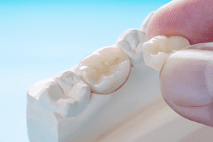 dental crowns lakeland family dental dentist in flowood ms